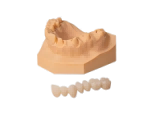 Fixed crown&bridge