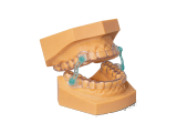 Orthodontics