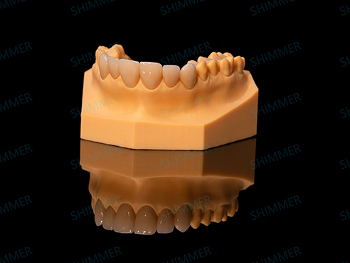 Full-Contour Zirconia Crown