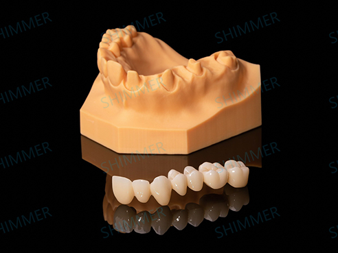 Layered Zirconia Bridge