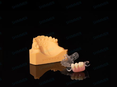 Removable Partial Denture
