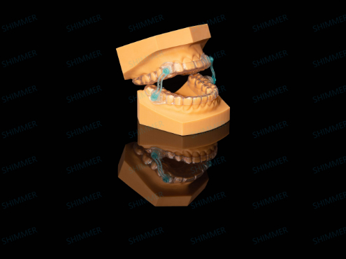Night Guard (Splint)