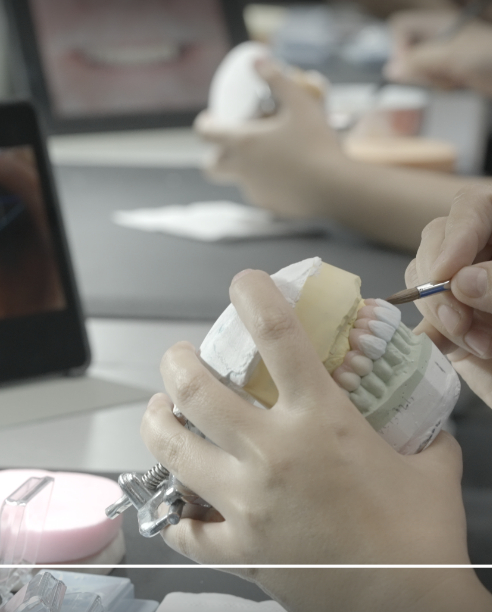 Complex case support (All-on-X/Full-Mouth)